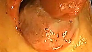 Ggg John Thompson the Sperm Shared Apartment