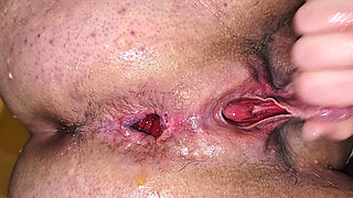 Gaping ass, big clit jerking