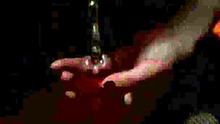 Urethral Sound First Fucks Me Then Breaks My Dick with a Big Probe