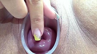 German Extreme Cervix Fucking