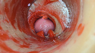 Camera Inside Deep Pussy Captures Overdose  Ejaculation of Sperm ASMR