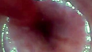 Endoscope POV: Test Tube Cock Urethral Insertion