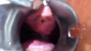 Speculum Cervix & Anal Exam Great View Inside