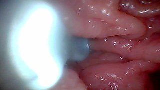 First Time: an Endoscope Reveals the G-spot up Close - Without Mounting!