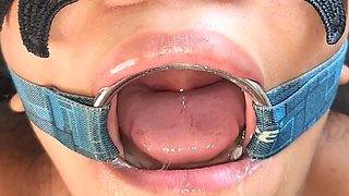 Bondage Open Mouth Spider Gag Oral Fixation Slave
