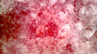 Medical Endoscope Oral Exam: Gummy Chewing, Extreme Teeth & Tongue Macro