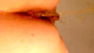 Voyeur doctor put a hidden cam in his exam room