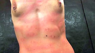 Amateur medical fetish and bdsm doctor pussy