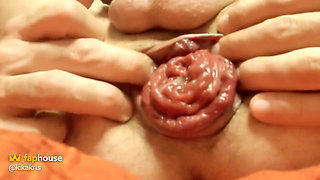 I Smash His Ass with My Big Finger