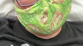 Welp, I Messed up My Foot