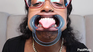 Youronlyphoenix Dental Retractor Mouth Tour