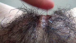 The Mound of the Clitoris