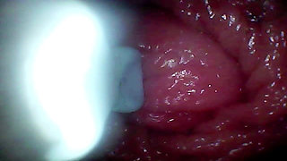 Endoscope Camera Records My Wife's G Spot. Educational Video Close up